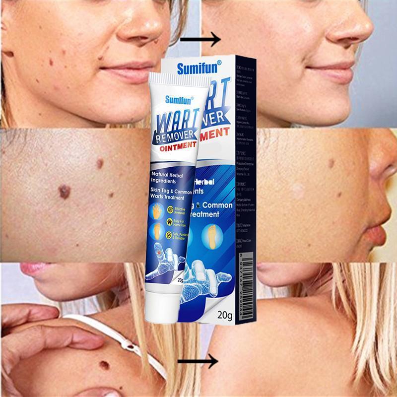 Instant Blemish Removal Gel (Limited time discount đ„ last day)