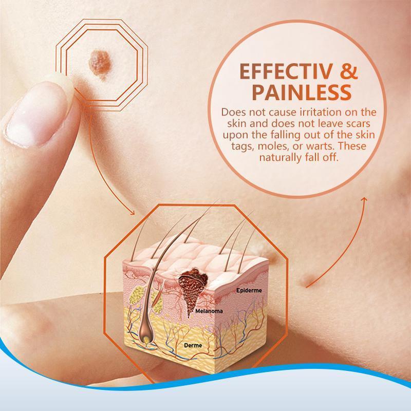 Instant Blemish Removal Gel (Limited time discount đ„ last day)