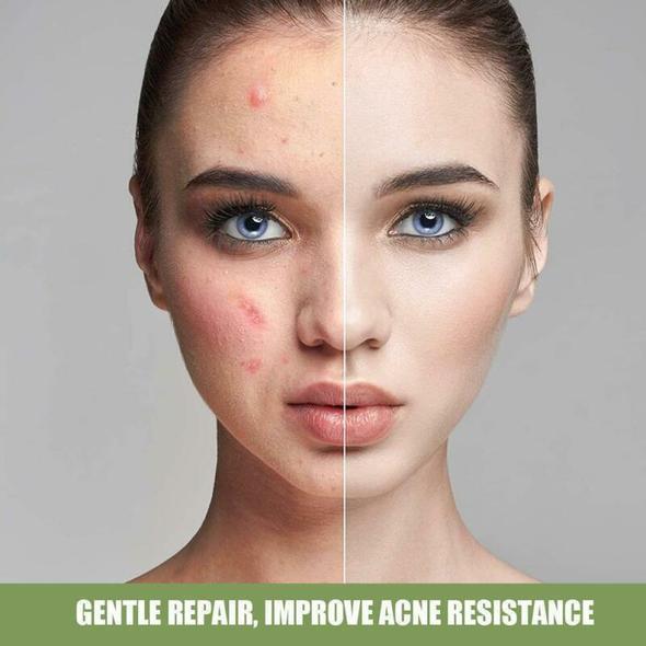 SALICYLIC ACID ICE CREAM MASK