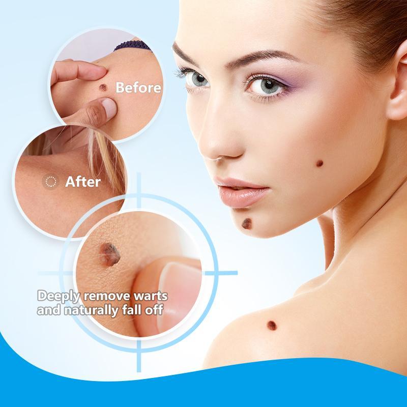 Instant Blemish Removal Gel (Limited time discount đ„ last day)