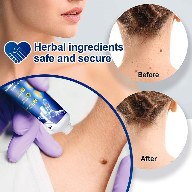 Instant Blemish Removal Gel (Limited time discount đ„ last day)