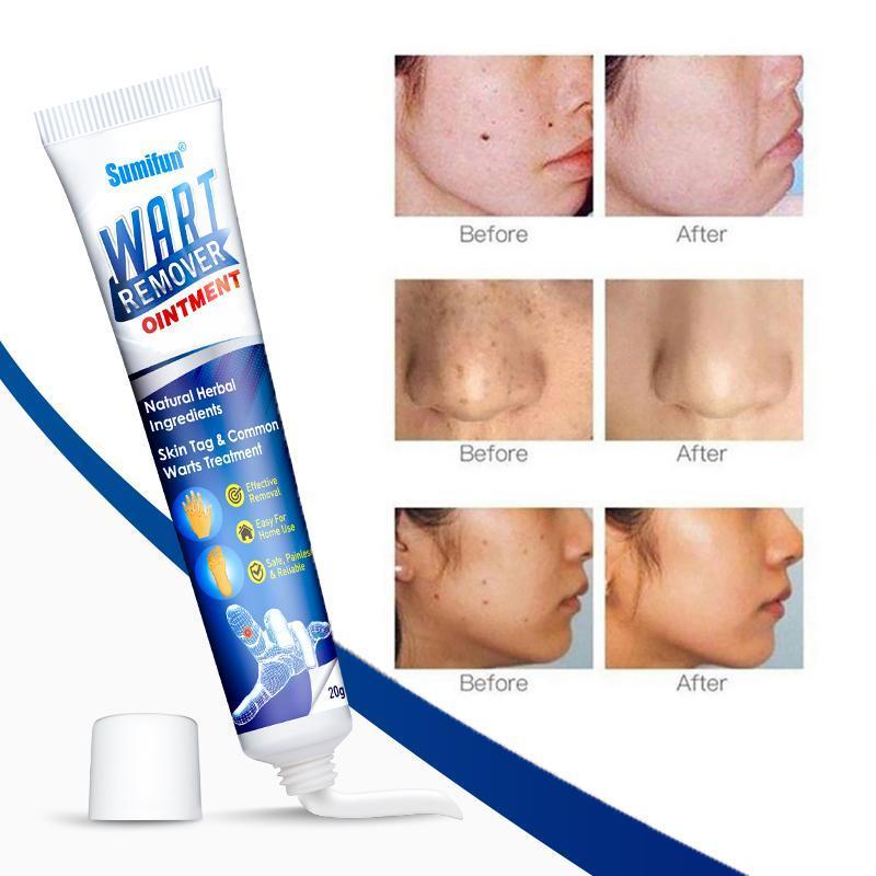 Instant Blemish Removal Gel (Limited time discount đ„ last day)