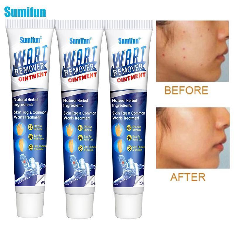 Instant Blemish Removal Gel (Limited time discount đ„ last day)