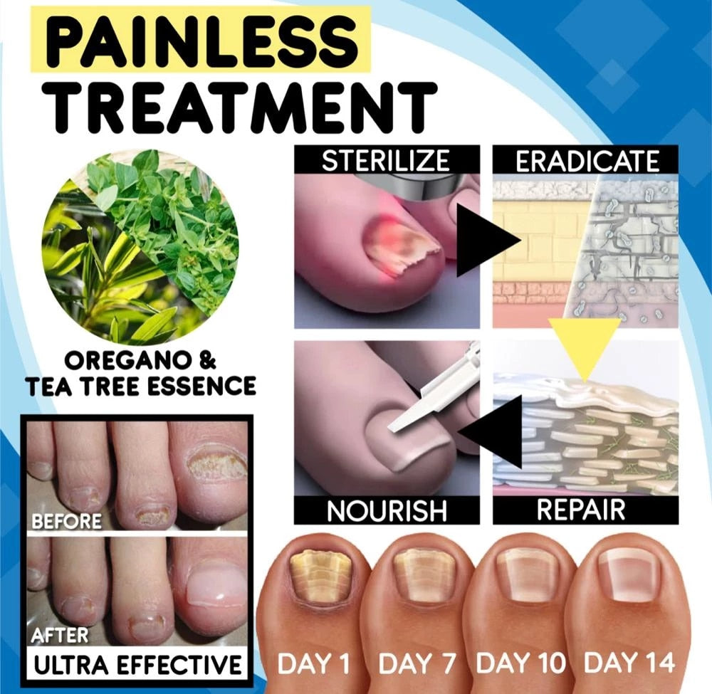 Anti-fungal Home Treatment Set