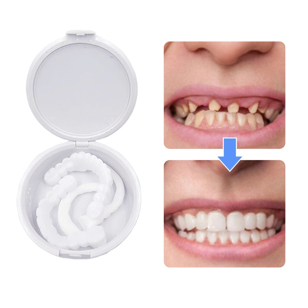 Adjustable Snap-On Dentures