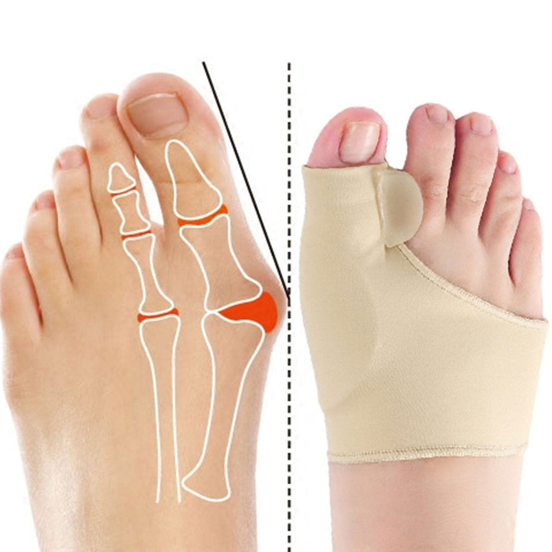 PREMIUM BUNION CORRECTOR SOCK