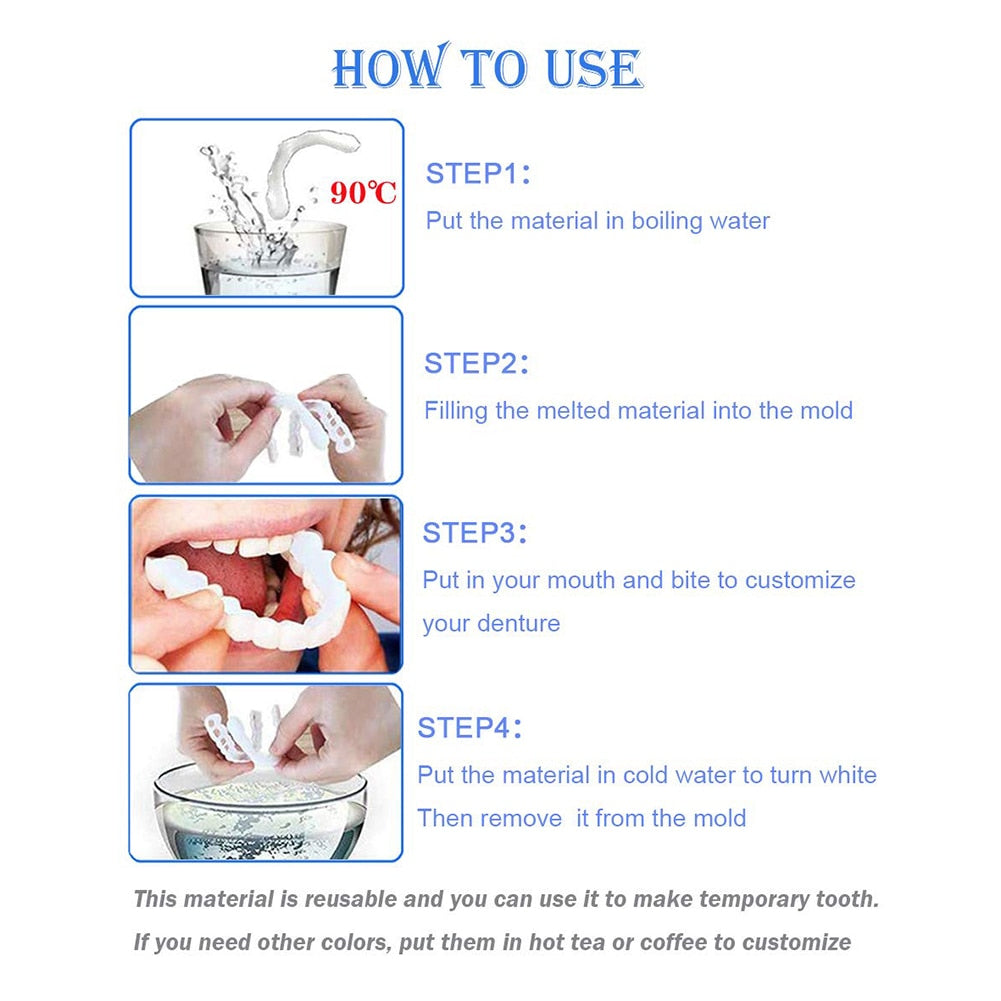 Adjustable Snap-On Dentures